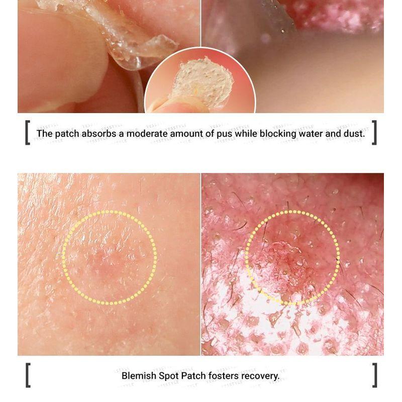 Elizavecca - Witch Piggy Hell Pore Blemish Spot Patch