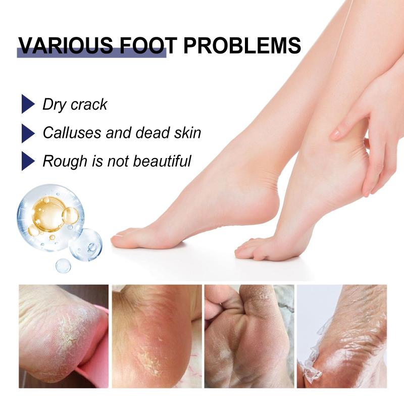 Foot Dryness And Cracking Care Cream Feet Skincare Moisturizing Hydrating Firming Nourishing Repairing Feet Cream Foot Skin Care