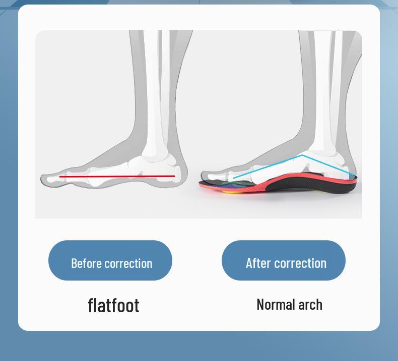 Flat Foot Orthotic Insoles with Arch Support for Shock Absorption in Sports
