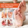 Sumifun 30/60/150ML Relieve Foot Odor Spray Foot Sweating Toe Anti-Itching Summer Essential Exercise Foot Care Bacteriostat Liquid Spray