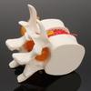 Human Anatomy Skeleton Spine Lumbar Disc Herniation Brain Skull Model Traumatic Pistol Medical Teaching Instrument for School