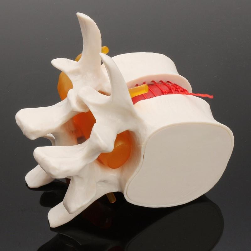 Human Anatomy Skeleton Spine Lumbar Disc Herniation Brain Skull Model Traumatic Pistol Medical Teaching Instrument for School
