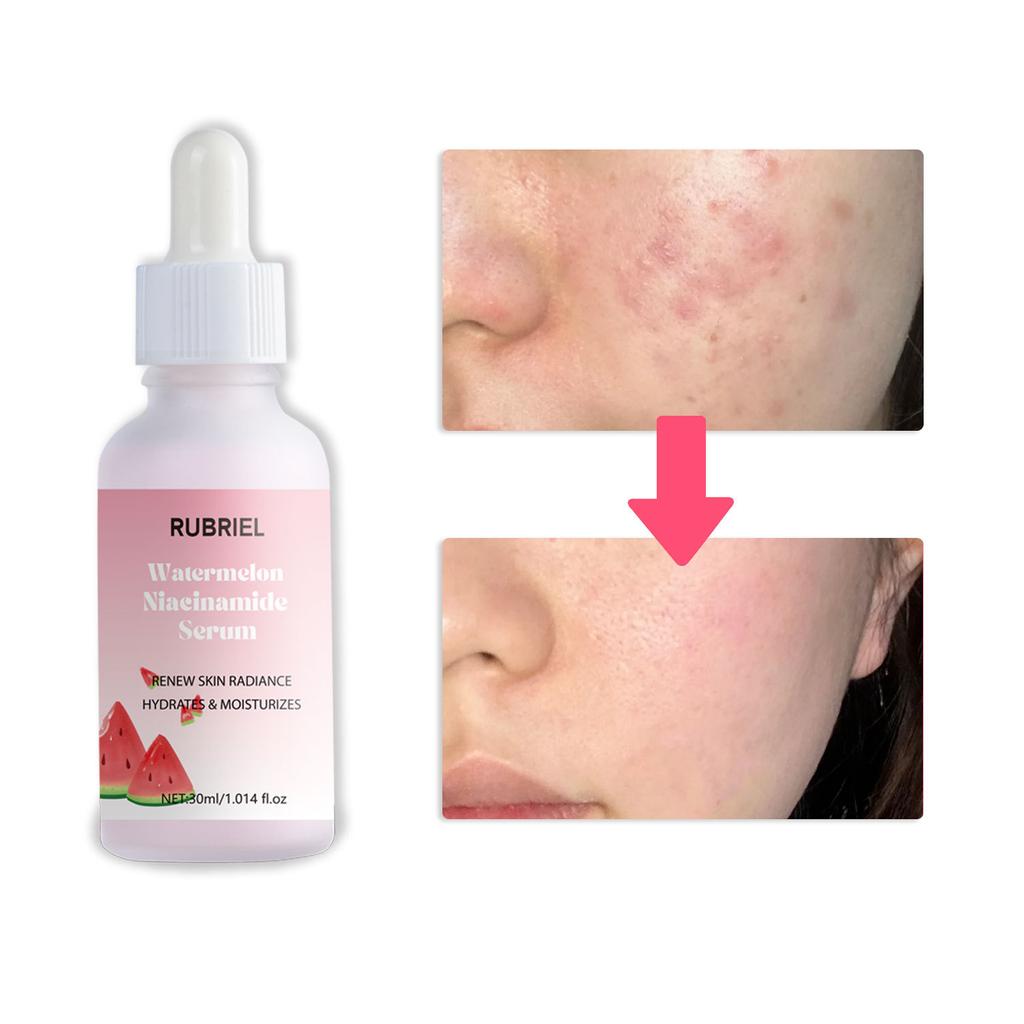 Watermelon Nicotinamide Extract 30ml Yellowing Brightening Skin Care