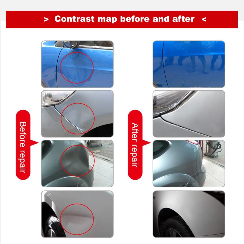Diy Paintless Dent Repair Kit Gliston Dent Puller Tools Slide Hammer For Car Hail Damage Dent Ding Remover
