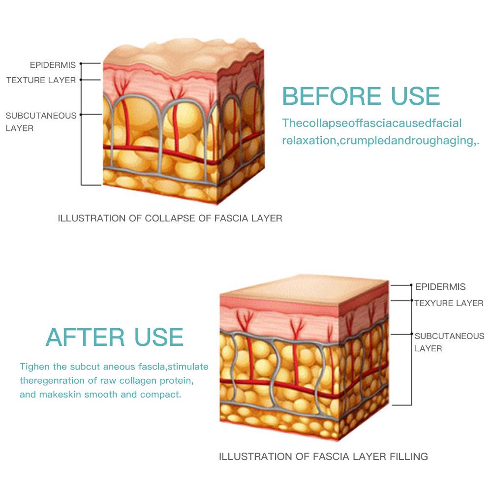 Mini Ultrasonic Sculpting Tool: HIFU EMS Pulse for Lifting & Wrinkle Smoothing