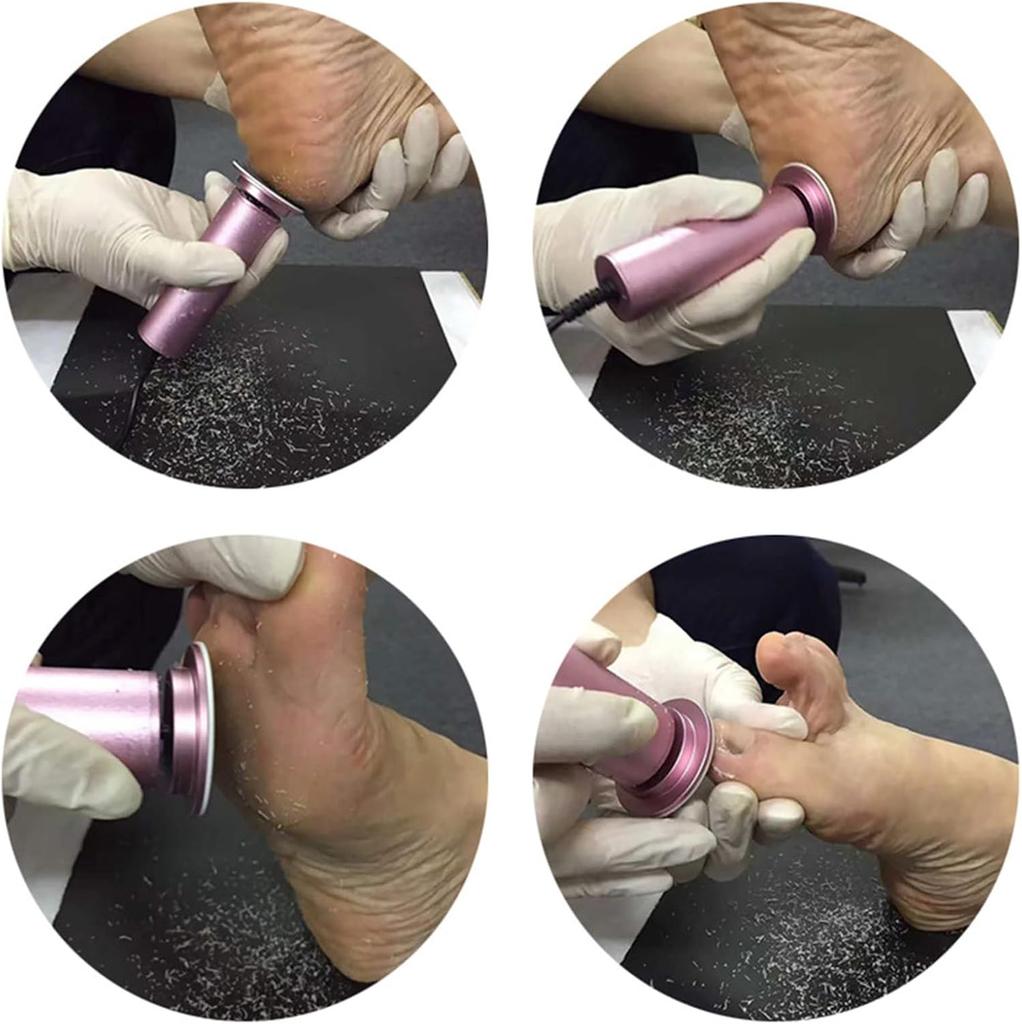 Electric Foot File Callus Remover, Professional Calluses Remover for Feet with Sandpaper Discs, Adjustable Speed