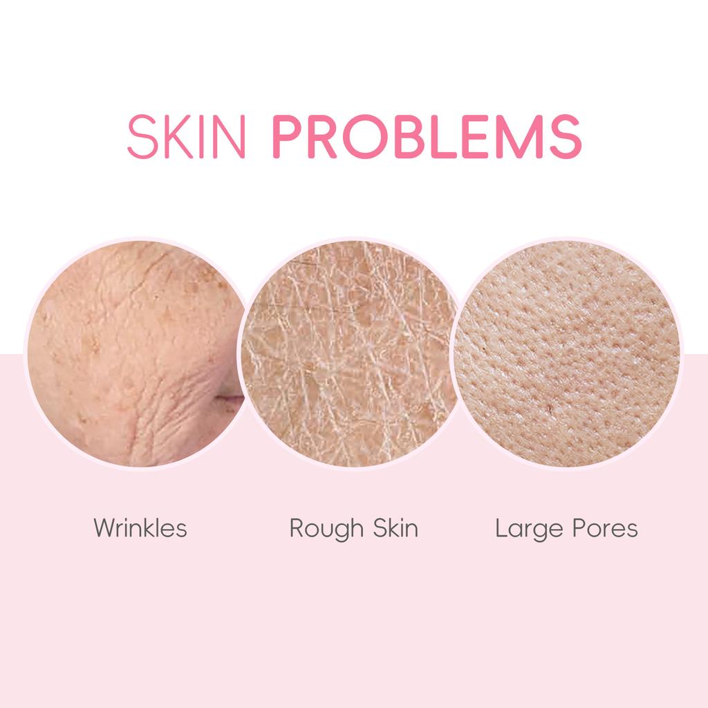 LAIKOU Sakura Kit Hautpflegesets Feuchtigkeitsspendend und Reduzierung feiner Linien Reinigung Poren Produkt 5-teiliges koreanisches Weihnachtsgeschenkset