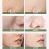 Gentle And Non-irritating Exfoliating Gel Cream Collagen Cleansing Cream New Lady Face Cream  Women