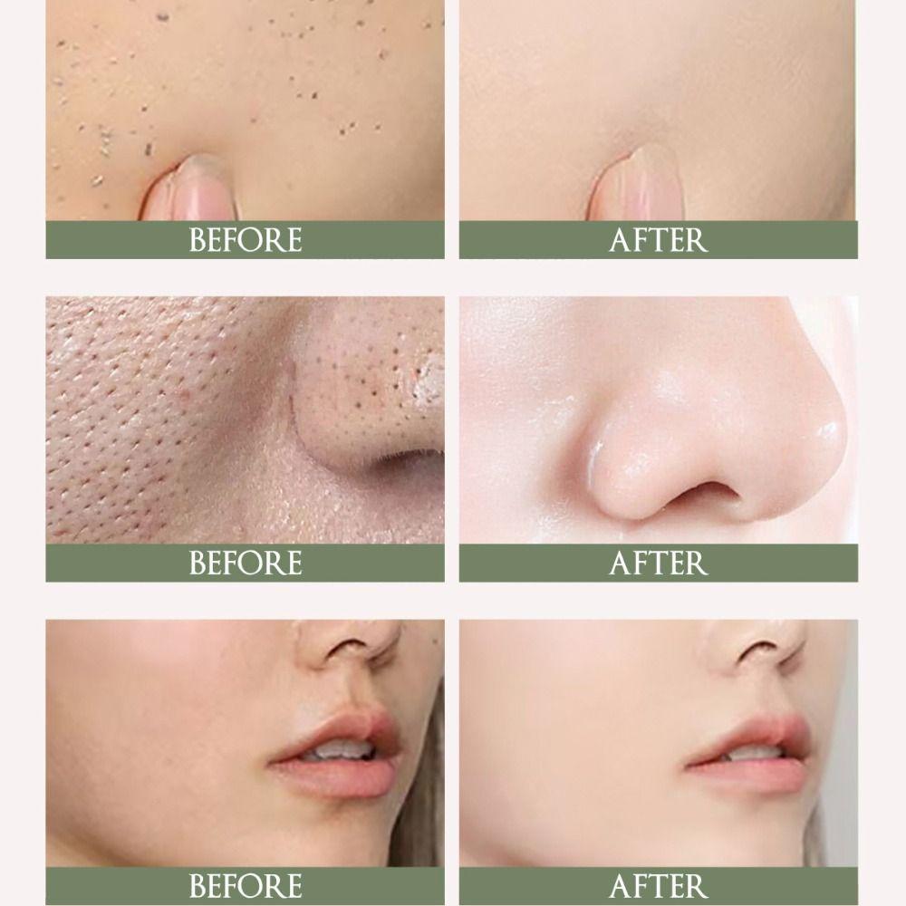 Gentle And Non-irritating Exfoliating Gel Cream Collagen Cleansing Cream New Lady Face Cream Women