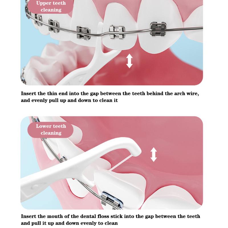 100Pcs/Pack Orthodontic Floss Bar Dental Bracket Steel Wire Slot Dental Floss For Orthodontic Teeth Orthodontic Floss Bar