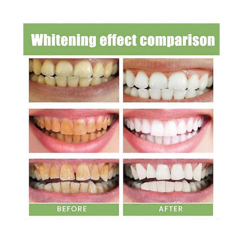 Ampoule Toothpaste,ampoule Tooth Serum, Ampoule Essence Toothpaste,fruit Acid Teeth Whitening Essence (1box/10pcs)