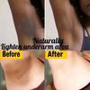 Crema blanqueadora para partes privadas, suero blanqueador para axilas, blanquea los glúteos y las rodillas, ilumina el interior del muslo, partes íntimas, elimina la melanina oscura