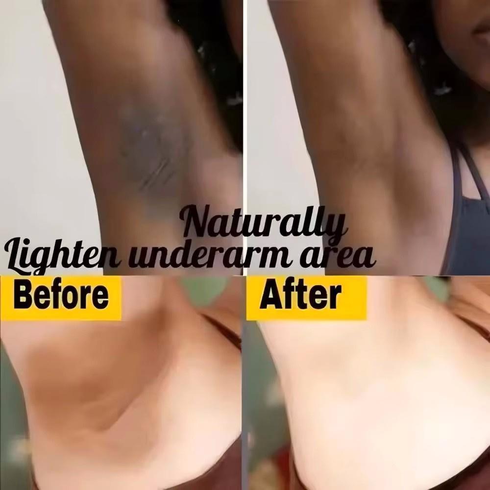 Crema blanqueadora para partes privadas, suero blanqueador para axilas, blanquea los glúteos y las rodillas, ilumina el interior del muslo, partes íntimas, elimina la melanina oscura