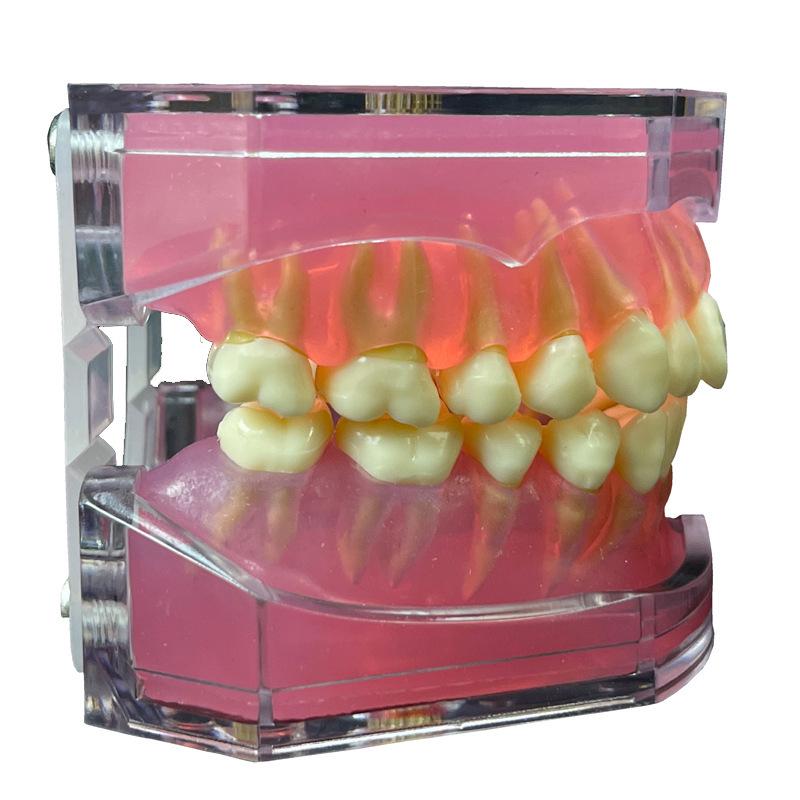 Прозора Знімна Повна Модель Щелепи з М'якими Яснами та Зубами для Підготовки до Імплантації