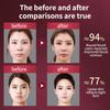 Facial Lifting Device LED Photon Therapy Facial Slimming Vibration Massager Double Chin V-shaped Cheek Lift Face