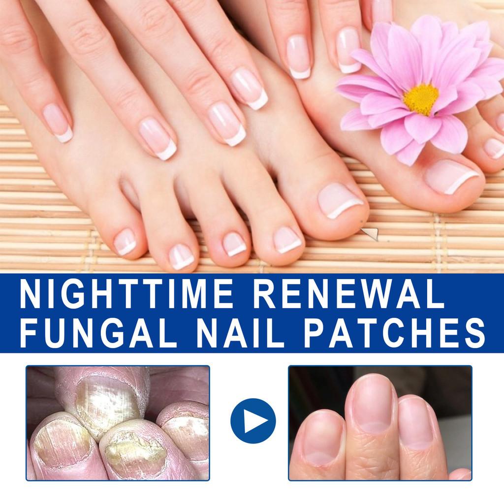 Ximonth Nighttime Nail Care Patches For Strengthening And Healing Weak Nails