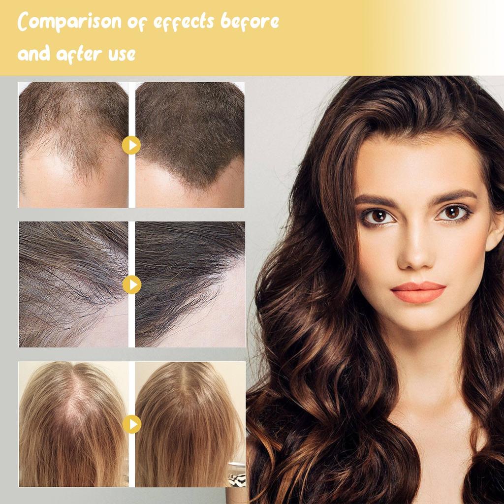 Hair Growth  Promotes Hair Growth , Promotes Thick Hair For Men And Women Hair Growth Oil,120g