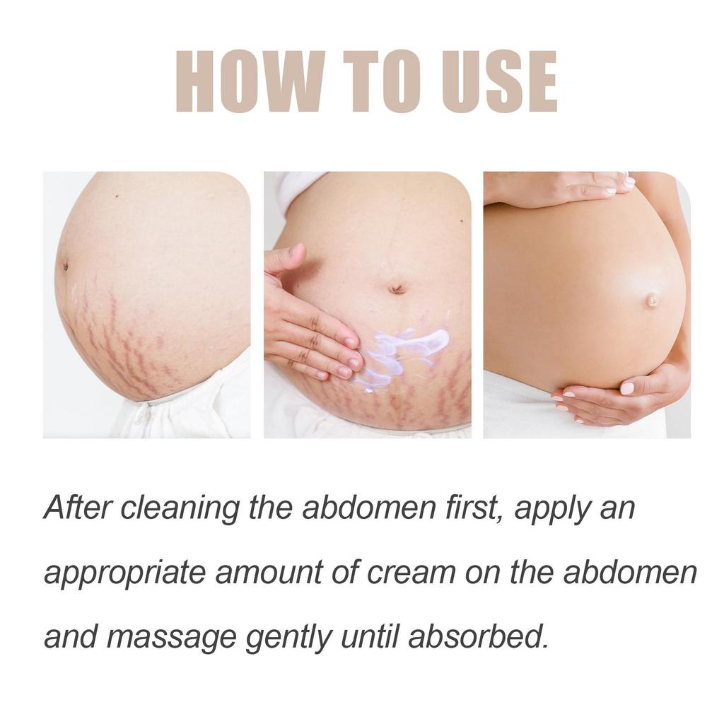 Wiieey Butter Moisturizing Cream Lightens Stretch Marks Repairs Skin Elasticity Firms & Smoothes