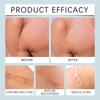 Laniska Silicone Scar Tape, 4cm×150cm, Soft & Breathable, for Scar Care & Skin Smoothing