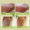 Ginger Foot Peel Spray, Foot Peel Callus Remover For Feet Spray, Foot Moisturiser Foot Care Spray, Foot Exfoliating Spray, Softener Foot Spray for Dea