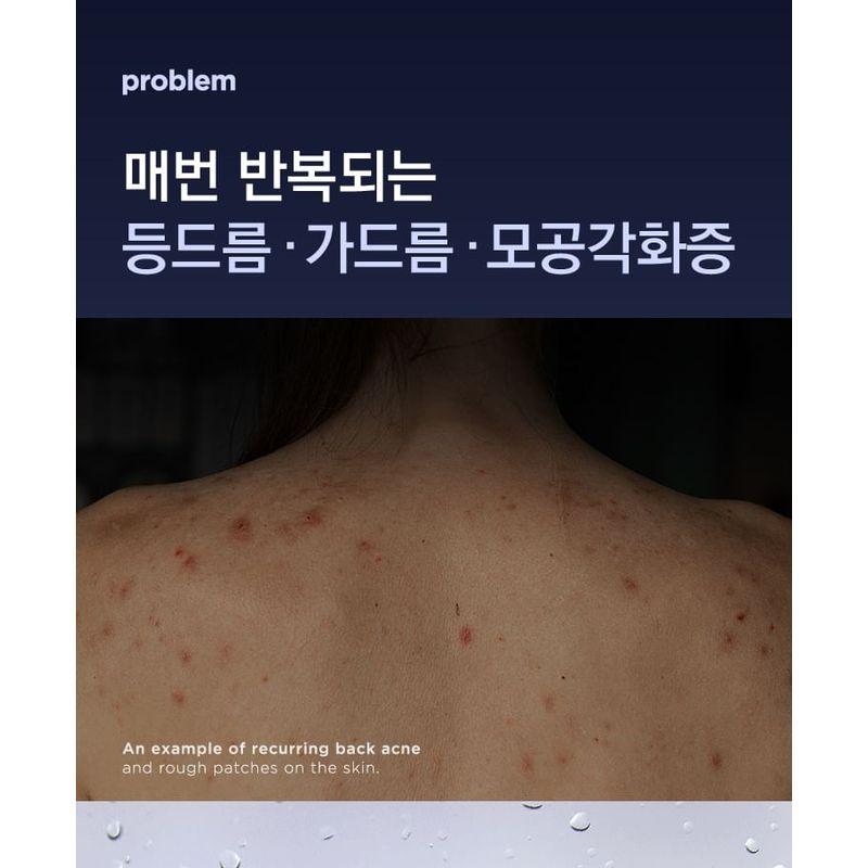 TOSOWOONG - Betaine Salicylate Body Wash