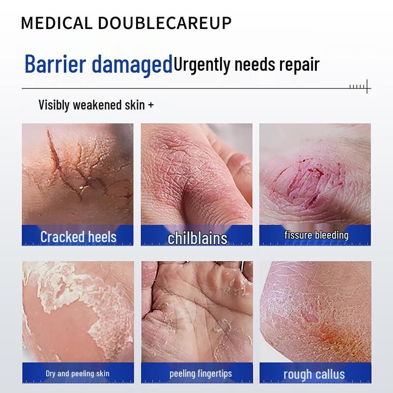 FIVERAMS Vaseline Hand & Foot Cracked Skin Care