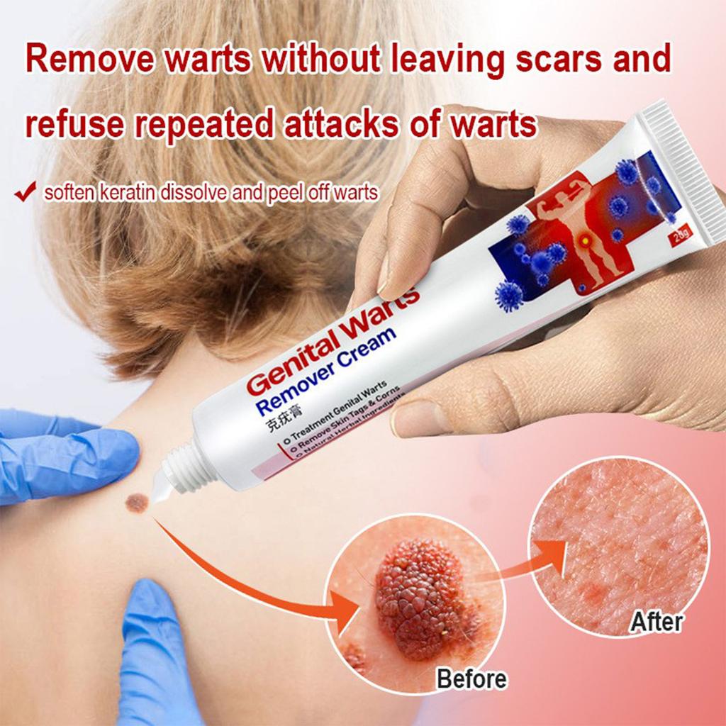Remover, Fast-acting Face Cream, Fast-acting  Ointment, Private S Face Cream With Gentle Ingredients For Care.