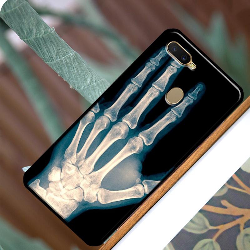 Etui na telefon z rentgenowską anatomią człowieka dla OPPO A15 A3S A5S A52 A72 A54 A74 A94 A83 A91 A93 A5 A9 A31 A53 A53S 2020