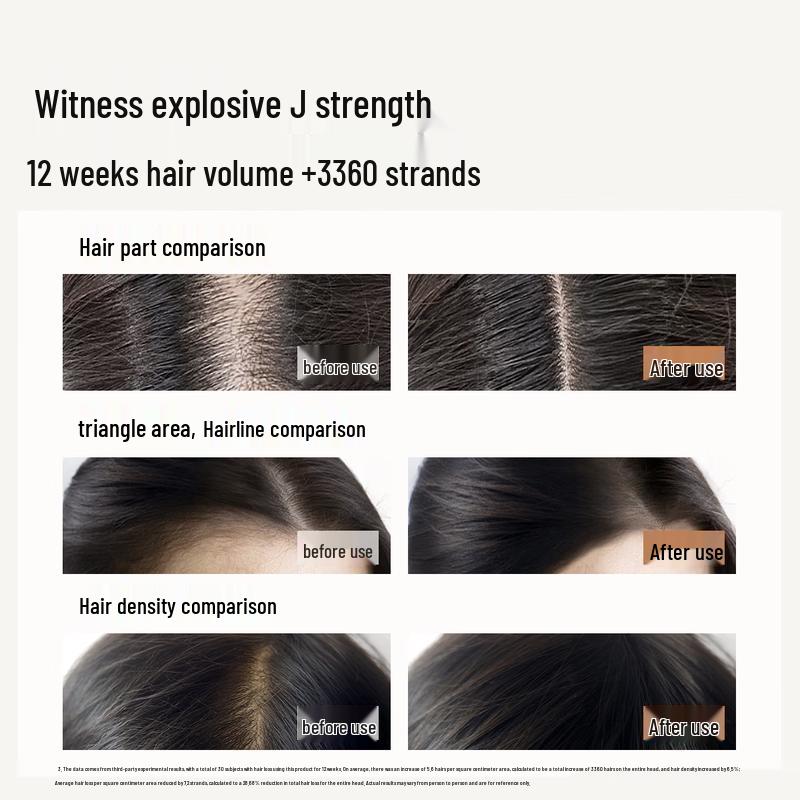 Roye Anti-Hair Loss Shampoo 258ml