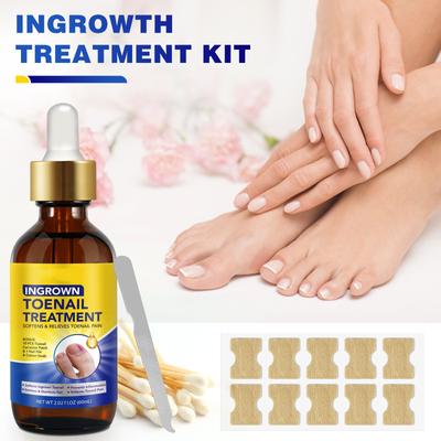 Onychomycosis Solution, Thickening Bright Onychomycosis Remover, Soft Onychomycosis, Hand And Foot Nail Care Solution 60ml
