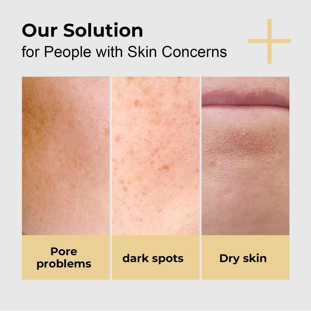 Vitamin C Brightening Serum-Brighten Skin & Oil Control-Improves The Look Of Dark Spots-Supports Skin's Natural Collagen Production-30ml