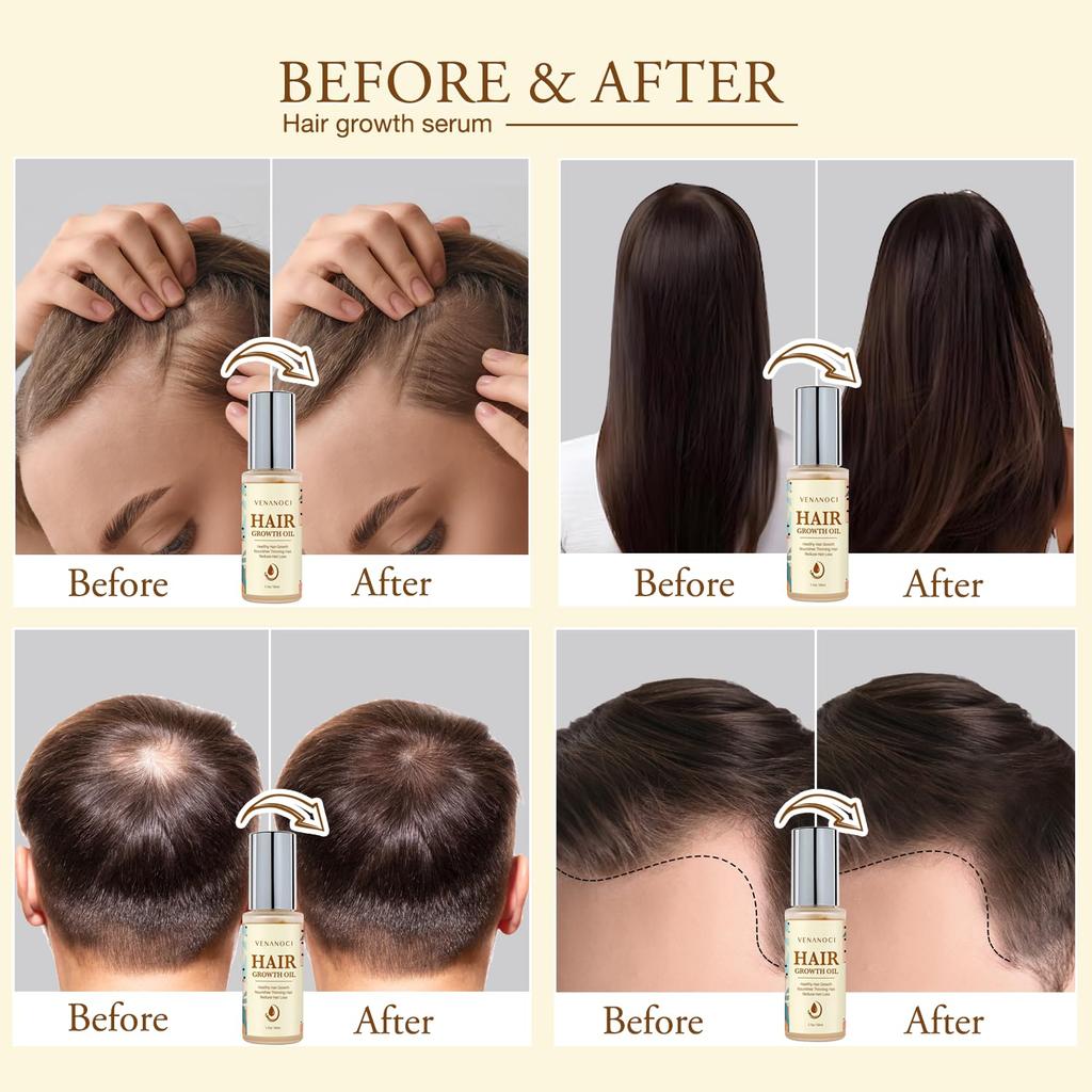 Long-lasting oil: natural hair regeneration essence for men and women–anti-hair loss and thinning care for all hair types