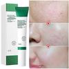 Pores Shrink Cream Moisturizing Acne Improve Acnes Blackheads Whitening Cream Anti-aging Oil Control Skin Care