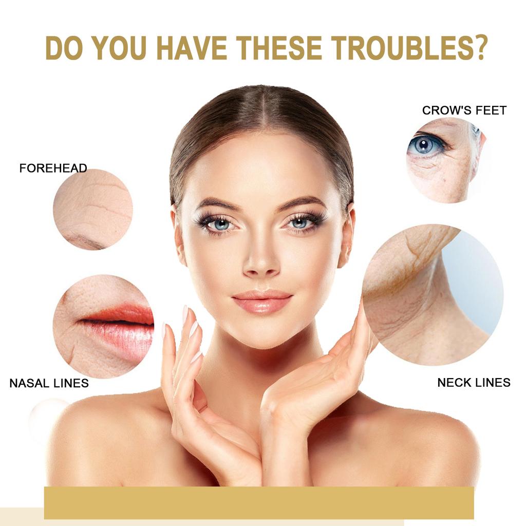 EELHOE Melanin korrigierendes Serum Dunkle Flecken aufhellen Sommersprossenentferner Melasmaentferner Aufhellendes Pigmentflecken Vitamin C Gesichtsessenz