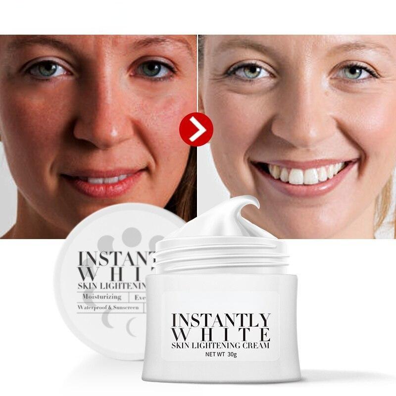 AuQuest Bělící krém na obličej Odstraňte pihy Tmavé skvrny Rozjasnění pleti Hydratační péče o pleť