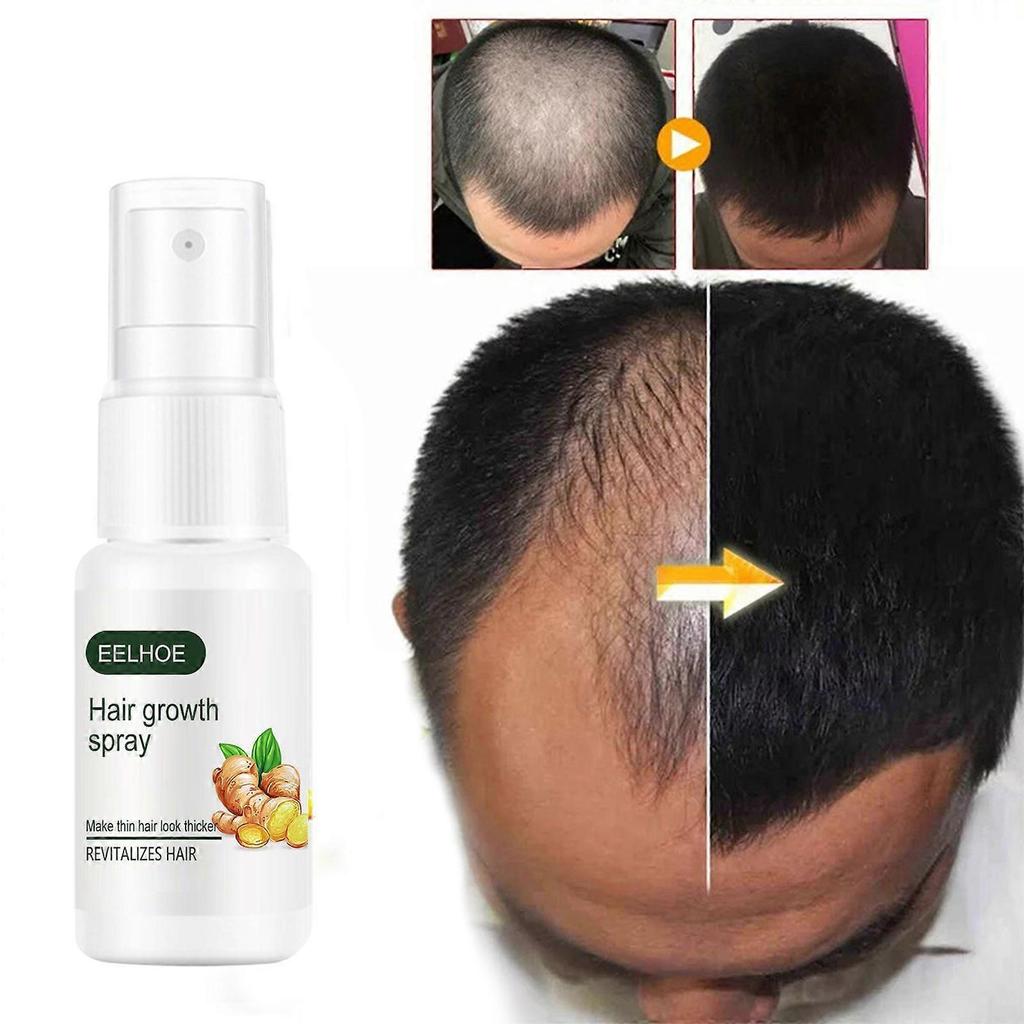 Eelhoe Ginger Hair Growth Essence - Strengthening And Repairing Hair Serum, Hair Nourishing And Root Care Spray