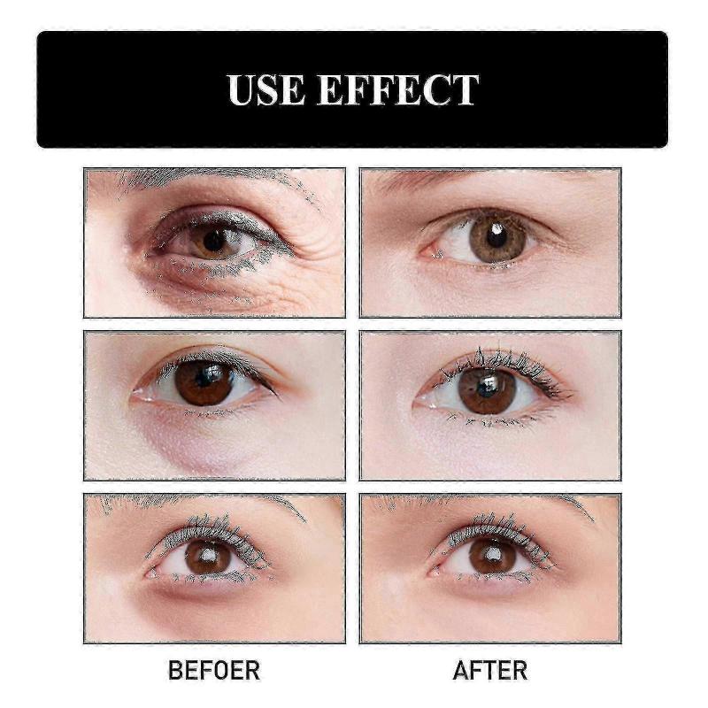 1pc Ouhoe Snake Venom Peptide Moisturizing Eye Cream Moisturizing, Lightening Fine Lines, Anti-aging And Anti-wrinkle 3PCS-4218669212962