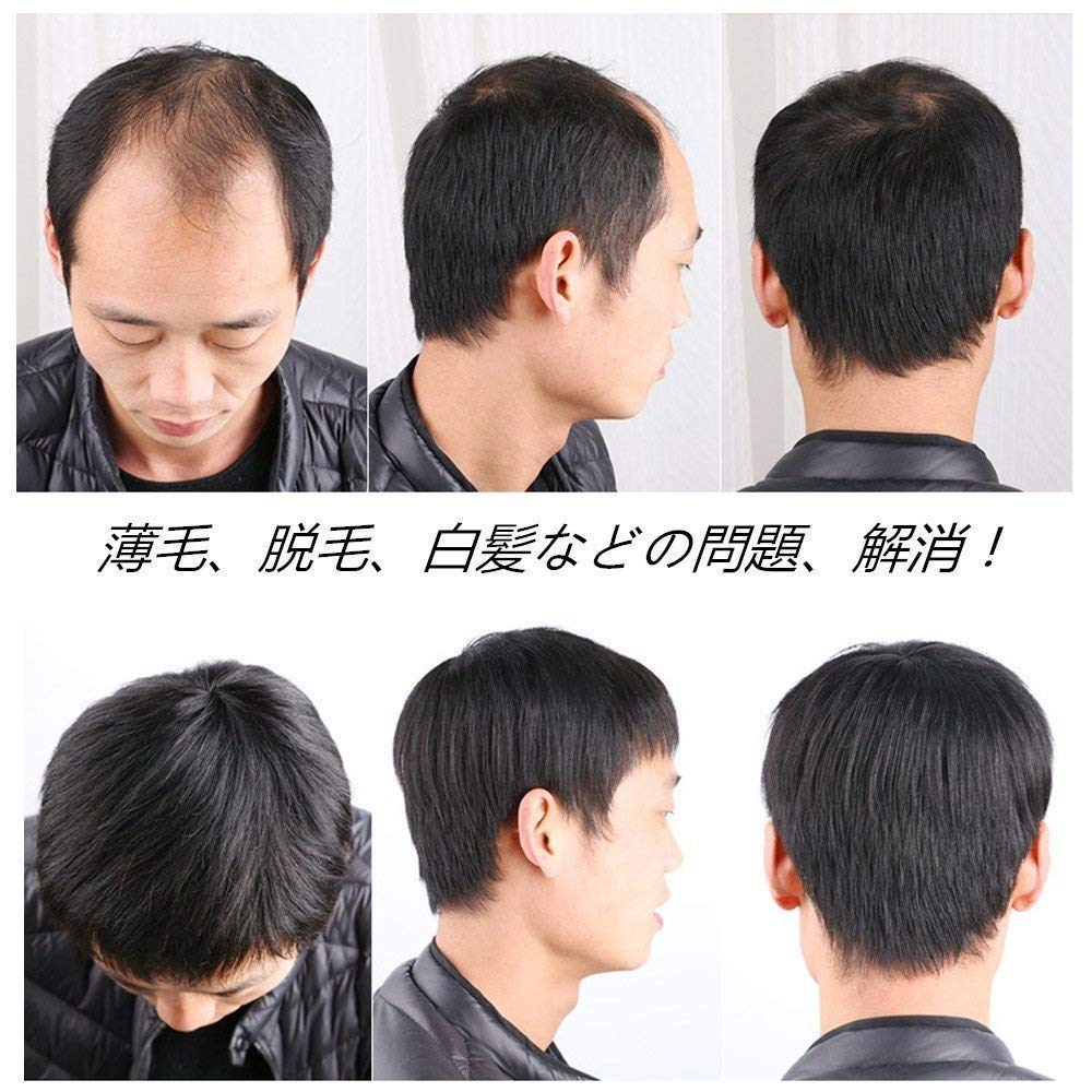 AISIHAIR Herren Kurzperücke, Haarteil, Medizinische Perücke, Schwarz, Kurz, Atmungsaktiv, Oberkopfbedeckung, 16*18cm