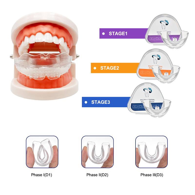 Ortodontická rovnátka Zubní rovnátka Smile Trenažér zarovnání zubů Instantní silikonový držák zubů Chránič úst Rovnátka na zuby Zásobník na zuby