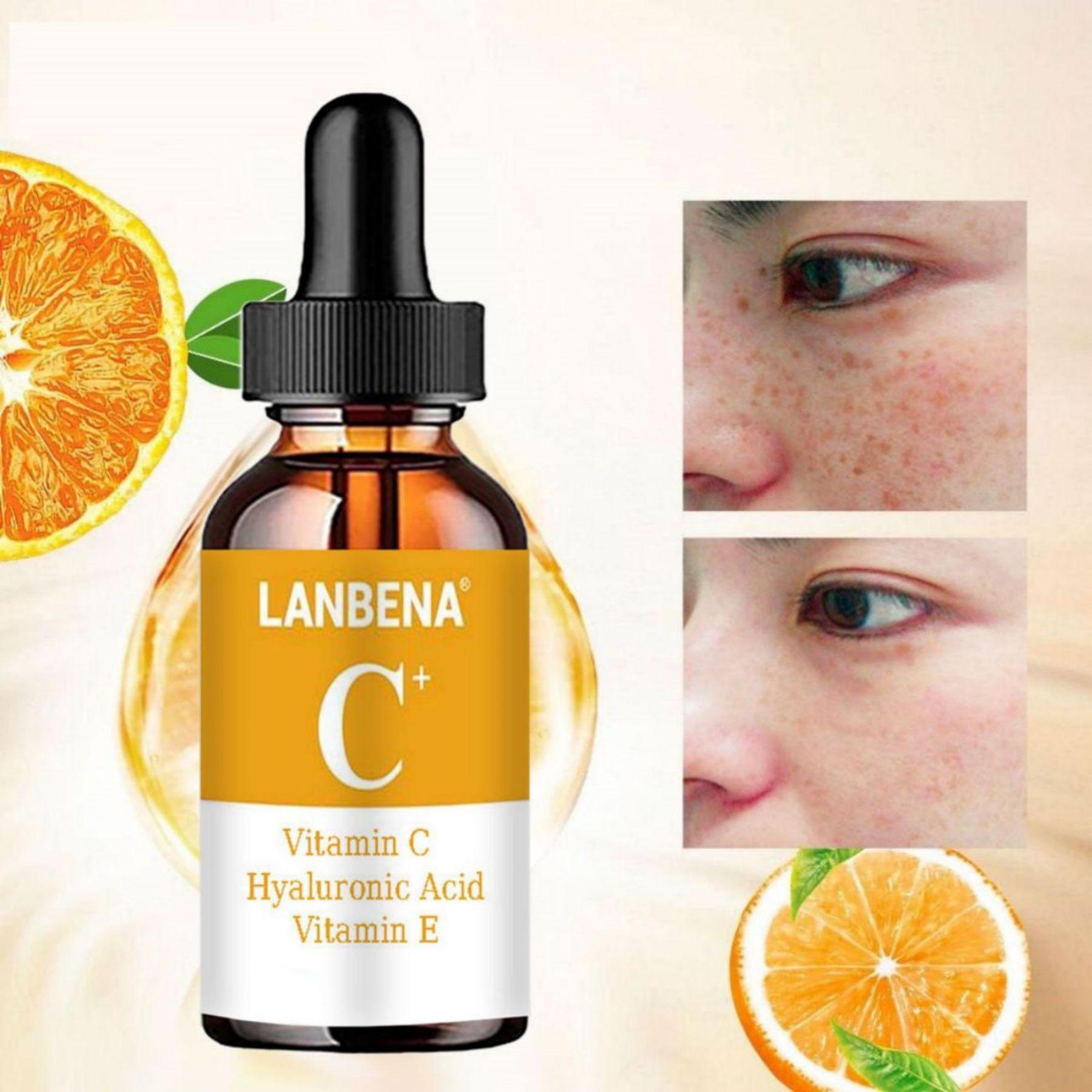 

Vitamin C Serum Remove Freckle Fade Dark Spot Anti-aging Whiten Moisturize Facial Serum FACE CARE