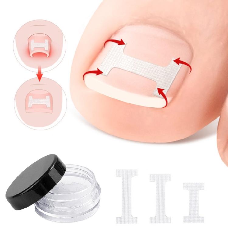 Ingrown Toenail Corrector Patches,Ingrown Toenail Treatments Tool Foot Care,10pcs Ingrown Toenail Corrector Strips