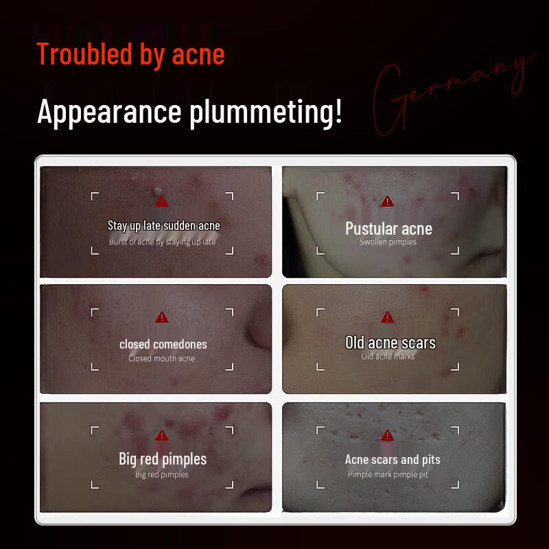 OSXE Anti-Acne Purifying Essence