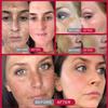 Powerful Spot-removing Whiten Cream Brighten Skin Fast Eliminates Melanin Pigmentation Melasma Dark Spots Moisturize Skin Care