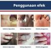 24PCS/box Corn Patch Corn Plaster Remover Corn Toe Pads Patch Adhesive Callus Cushion Non-woven Fabric Toe Corn Callus Removal
