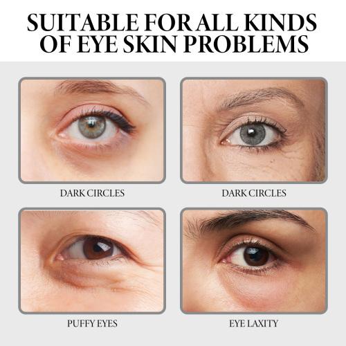 Hoygi Anti Wrinkle Whitening Cream Black Rim Of Eye Pouch Firming Moisture To Brighten The