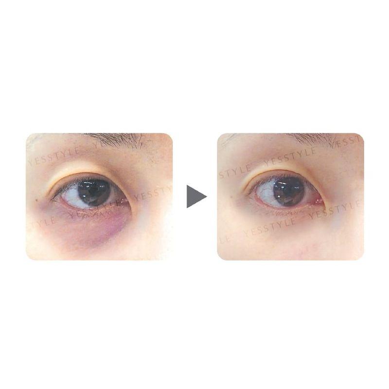 Zino - Dark Circle Removal Golden Eye Mask