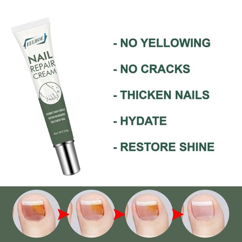 Crème de Réparation pour Ongles pour des Ongles Sains et Forts et Soin Doux des Pieds 20g Pour le Traitement des Ongles Endommagés