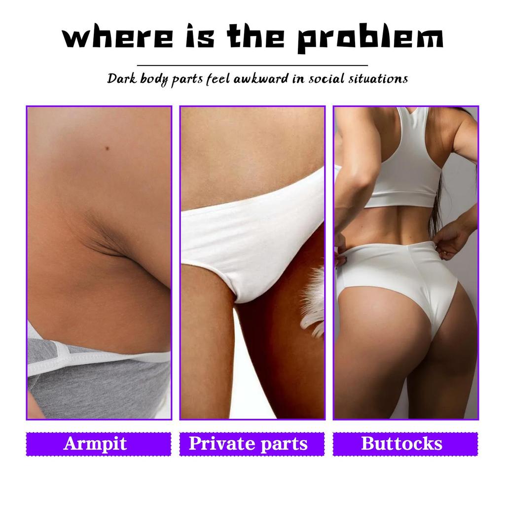 Inner Thighs Whitening Cream Moisturizing Skin Brightening Cream