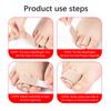 2Pcs Toe Finger Straightener Bend Toe Valgus Corrector Bandage Toe Separator Splint Wraps Foot Stretcher Care Tool