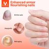 MeiYanQiong Nail Repair Treatment Lavender Nail Essential Oil Nail Art & Tools Healthy Nail Treatment Foot Care